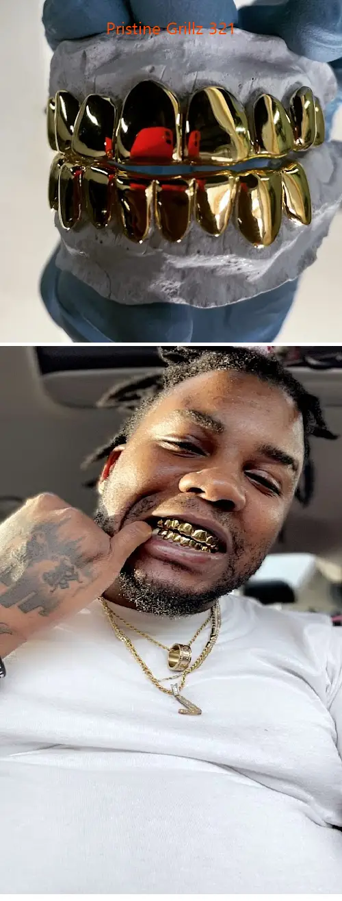 Pristine Grillz 321
