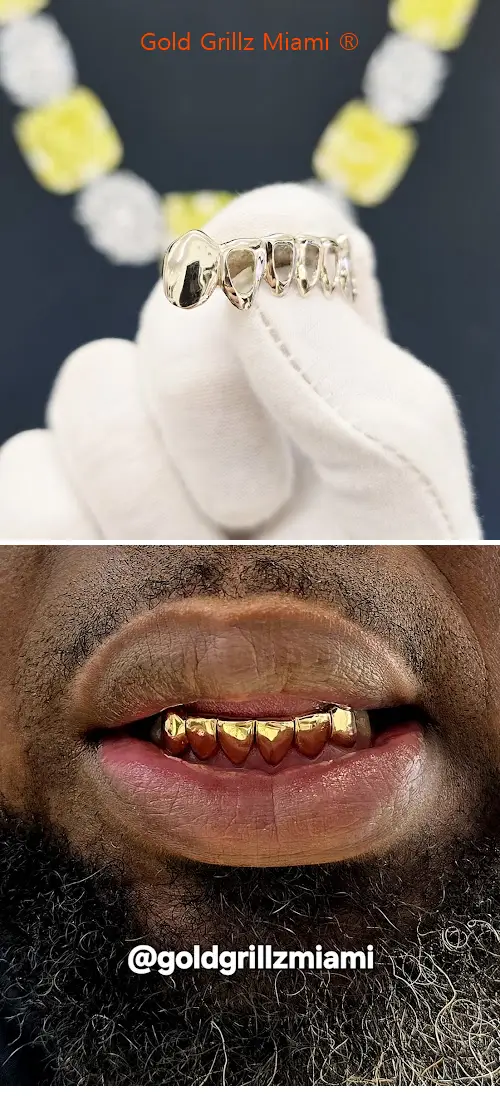 Gold Grillz Miami ®