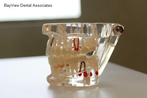 BayView Dental Associates