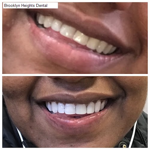 Brooklyn Heights Dental